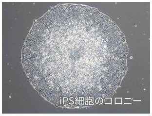 iPS細胞のコロニー